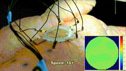 3D打印新成果!新技術或將助力診斷監測新冠肺炎(圖3) 3D打印新成果!新技術或將助力診斷監測新冠肺炎(圖3)