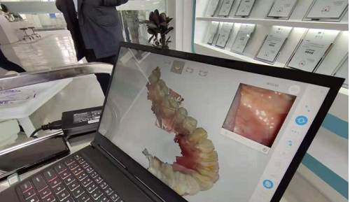 3D打印技術在牙科義齒領域中牙套制作的應用是怎樣的呢?(圖2) 3D打印技術在牙科義齒領域中牙套制作的應用是怎樣的呢?(圖2)